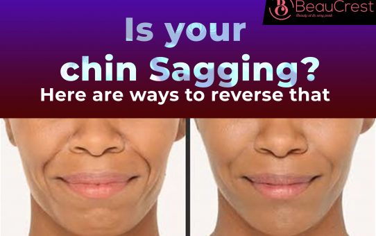 Is Your Chin Sagging? Here are 15 Ways to Reverse “Double Chin”