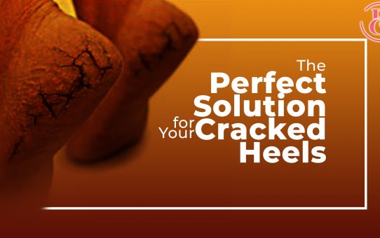 9 Tips to Help Heal Your Cracked Heels