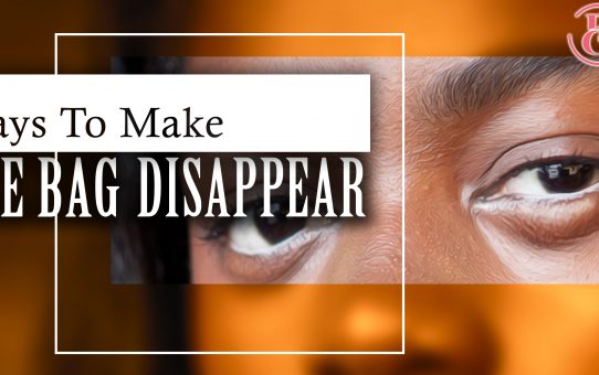 13 Ways to Make Those Eye Bags Disappear