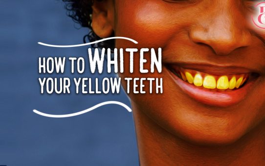 Top 9 Tips for Whitening Yellow Teeth