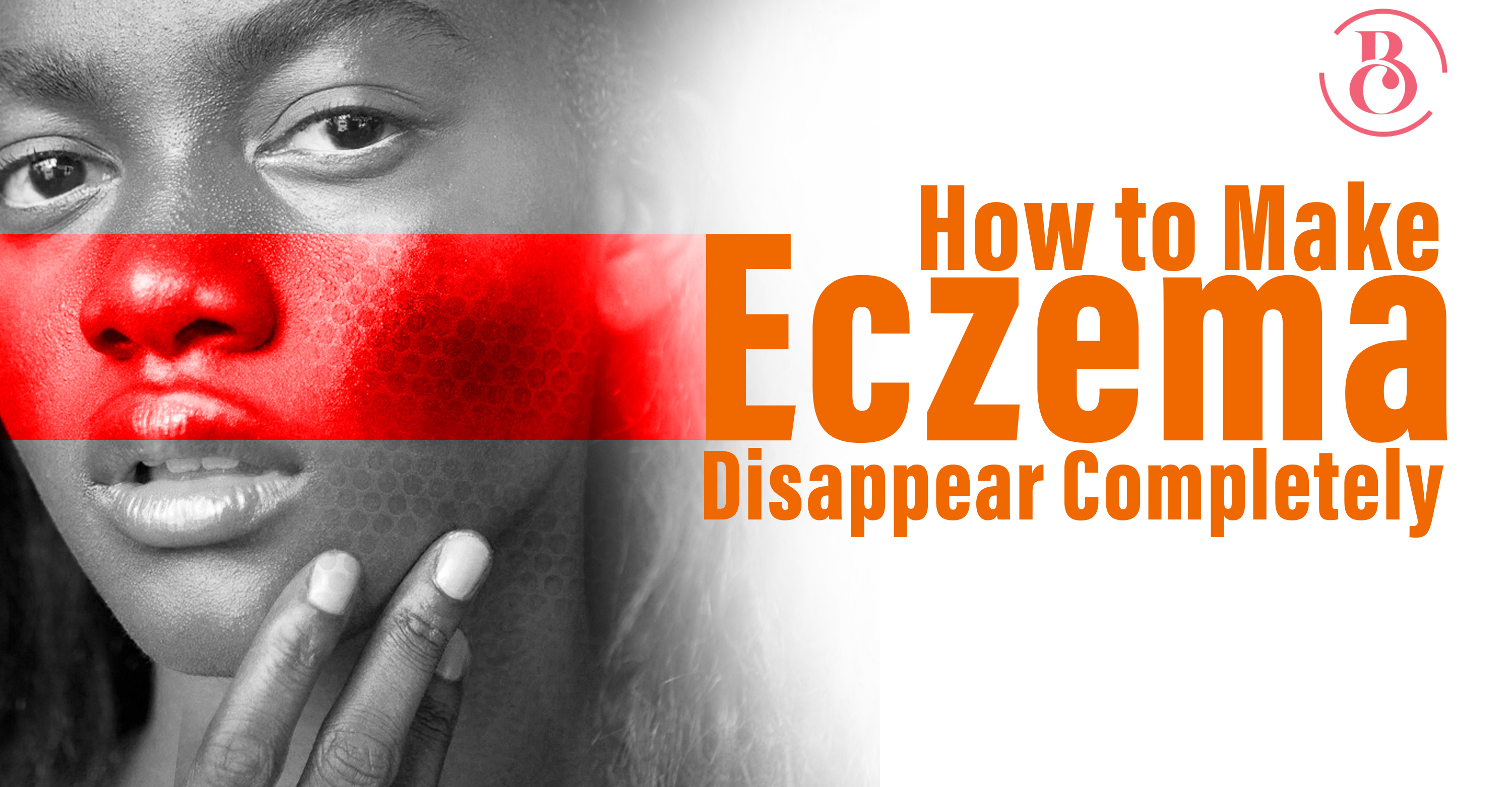 How to Make Eczema Disappear Completely