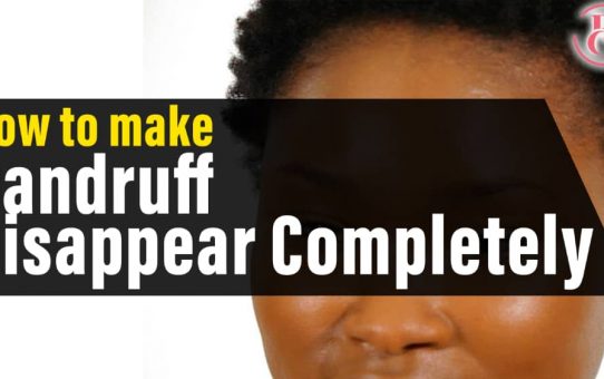 How to Make Dandruff Disappear Completely