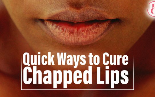 10 Quick Ways to Treat Chapped Lips