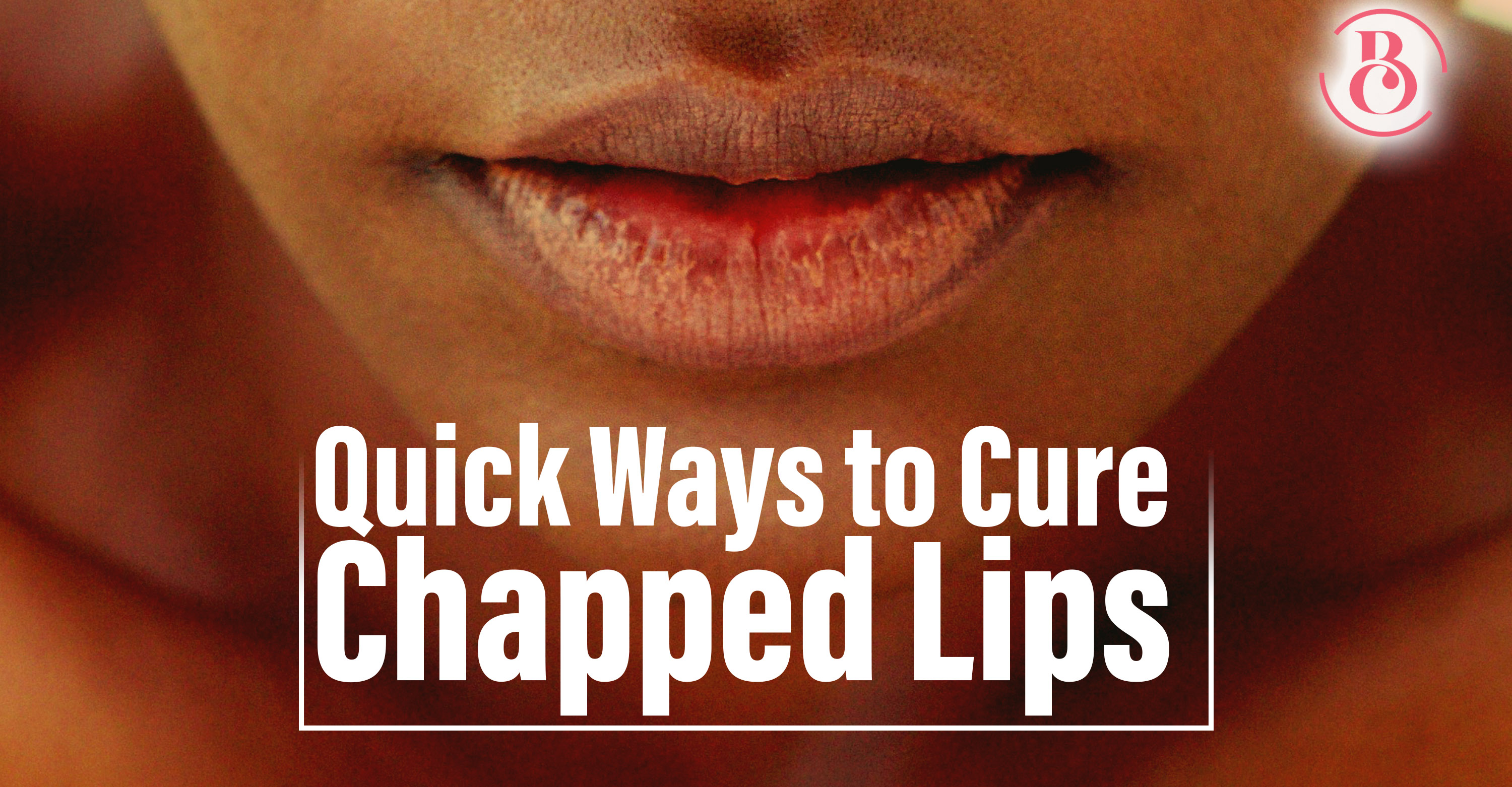 10 Quick Ways to Treat Chapped Lips