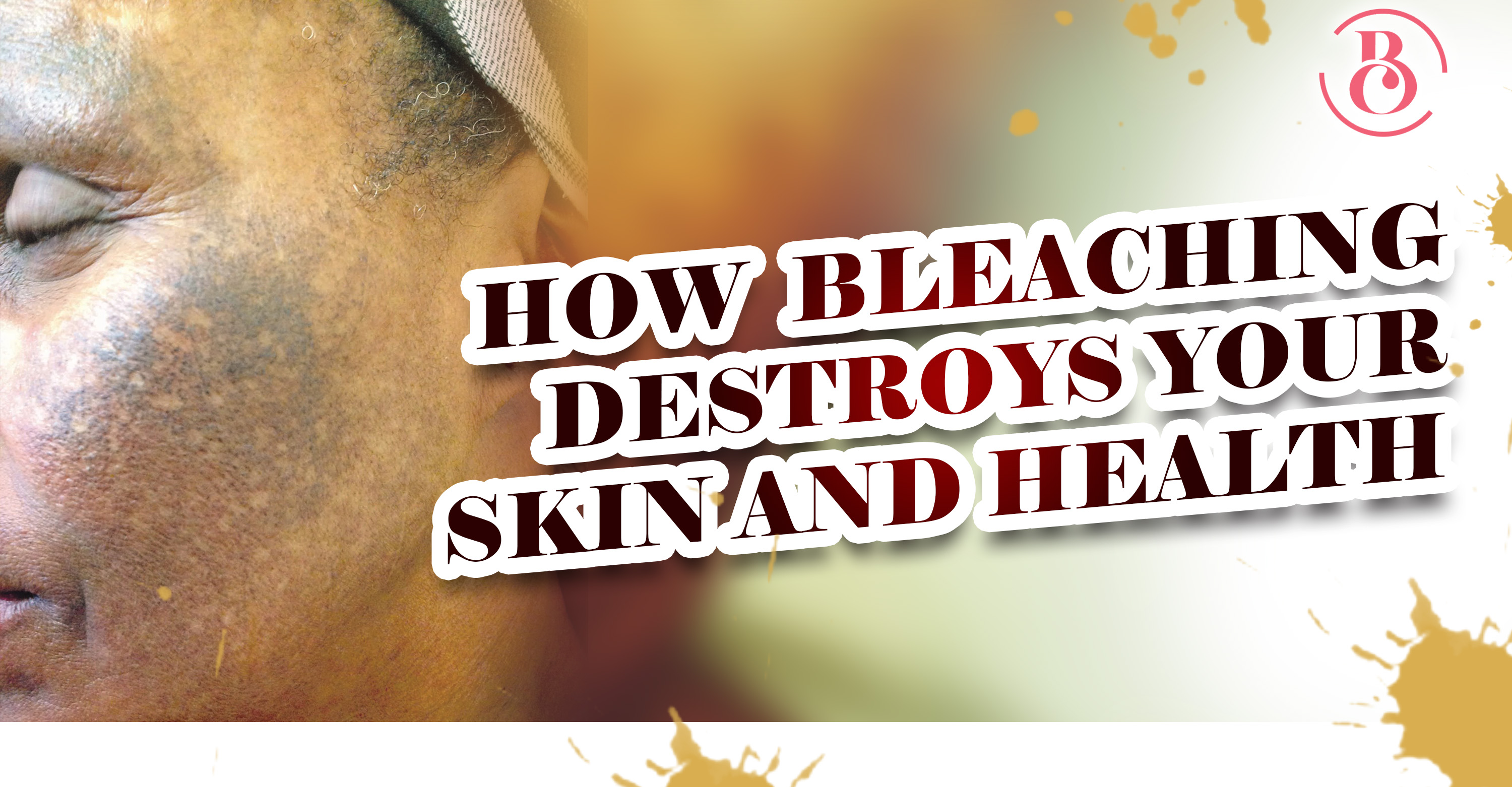 5 Ways Bleaching Destroys Your Skin and Health