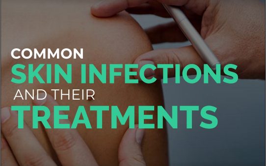 Common Skin Infections and Their Treatments