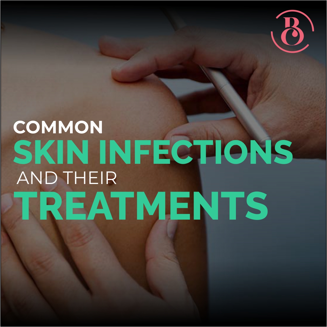 Common Skin Infections and Their Treatments