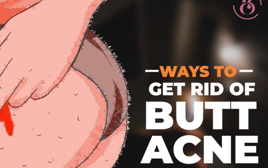 4 Ways to Get Rid of Butt Acne