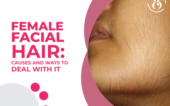 Female Facial Hair: Causes and Ways to Deal with It