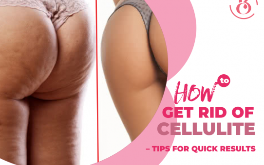 How to Get Rid of Cellulite – Tips for Quick Results