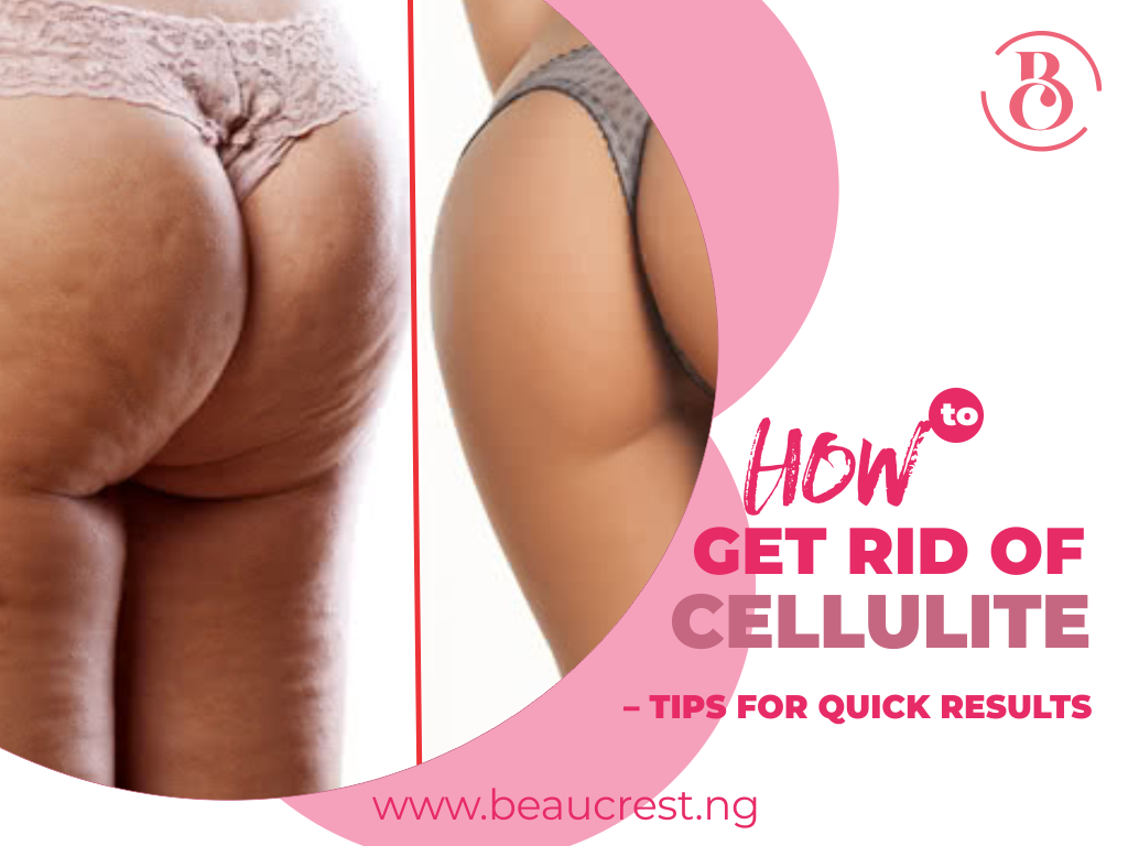 How to Get Rid of Cellulite – Tips for Quick Results