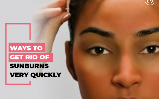 8 Ways to Get Rid of Sunburn Very Quickly