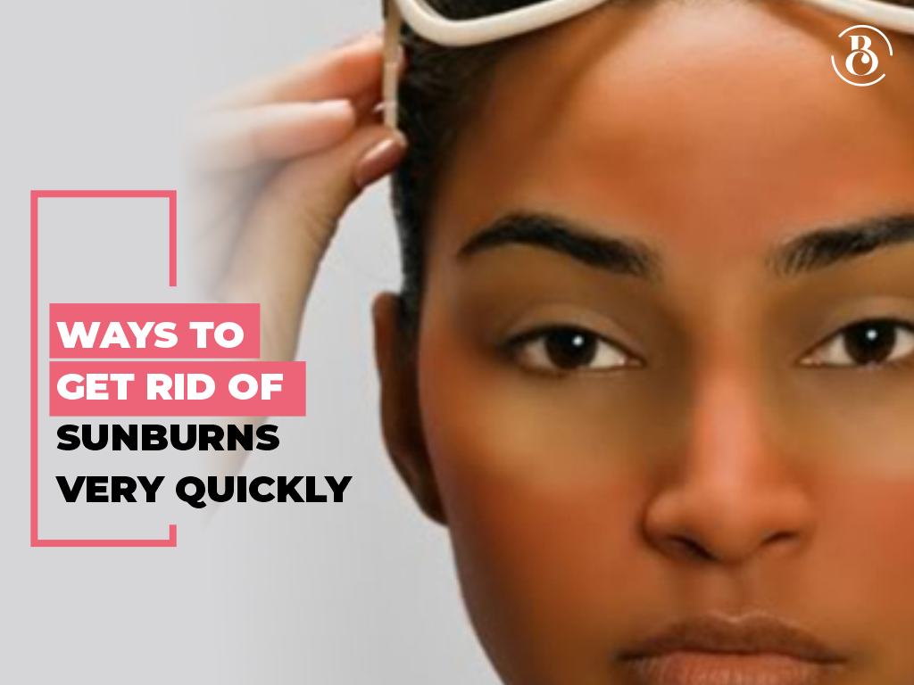 8 Ways to Get Rid of Sunburn Very Quickly