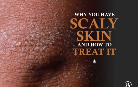 Why You Have Scaly Skin and How To Treat It