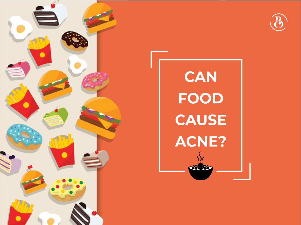 Can Food Cause Acne?