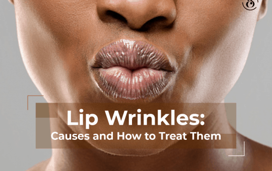 Lip Wrinkles: Causes and How to Treat Them
