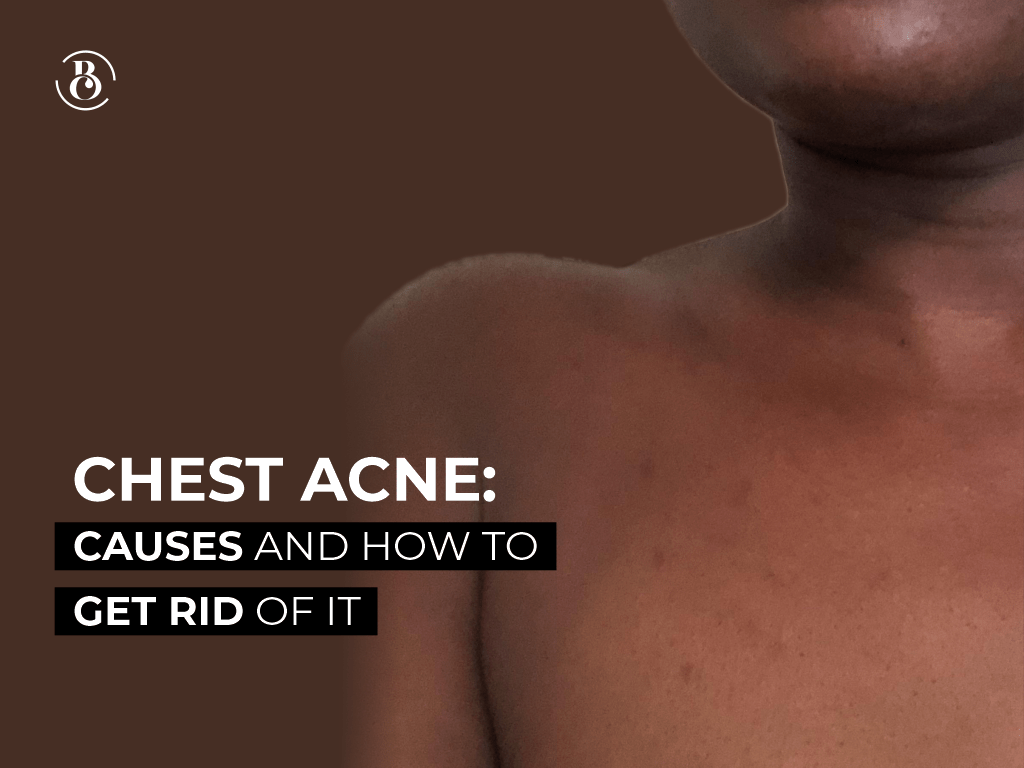 Chest Acne: Causes and How to Get Rid of It