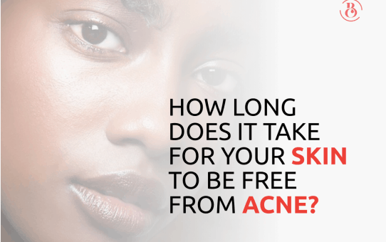 How Long Does It Take for Your Skin to be Free from Acne?