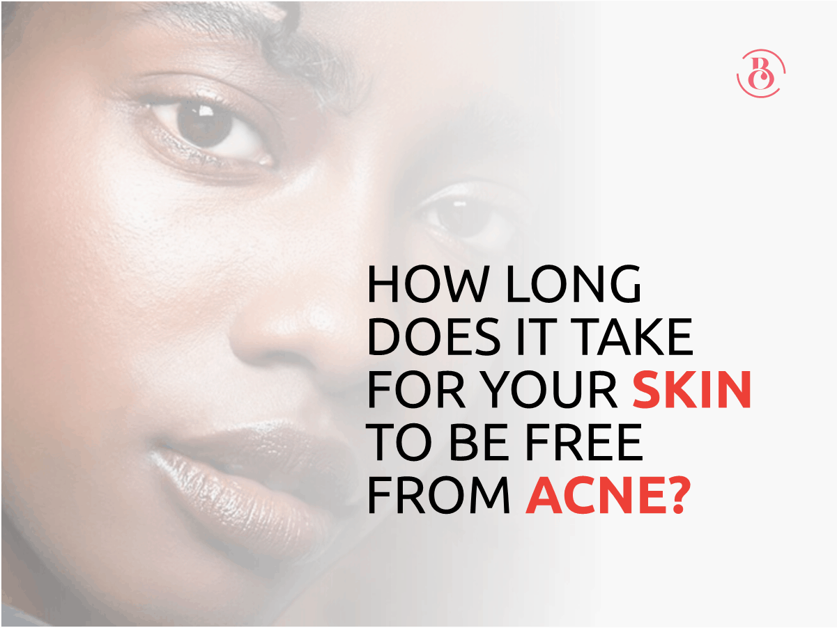 How Long Does It Take for Your Skin to be Free from Acne?
